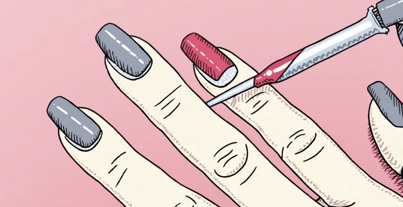 can-nail-polish-kill-ringworm