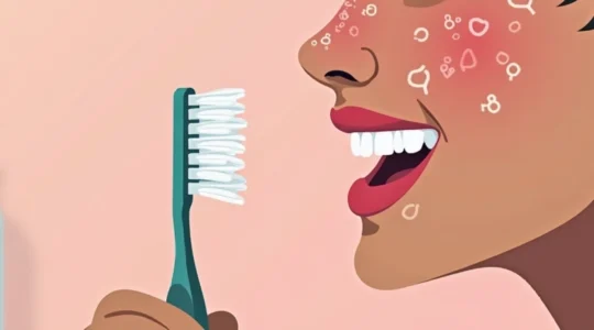 can-not-brushing-your-teeth-cause-acne