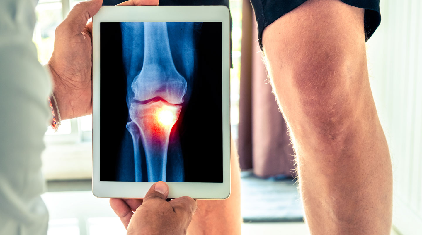 Extreme close-up of a robotic surgical system control interface displaying a 3D knee joint mapping on a high-resolution screen, with blurred medical equipment in the background